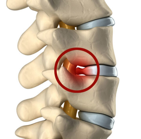  Наиболее характерные признаки повреждения