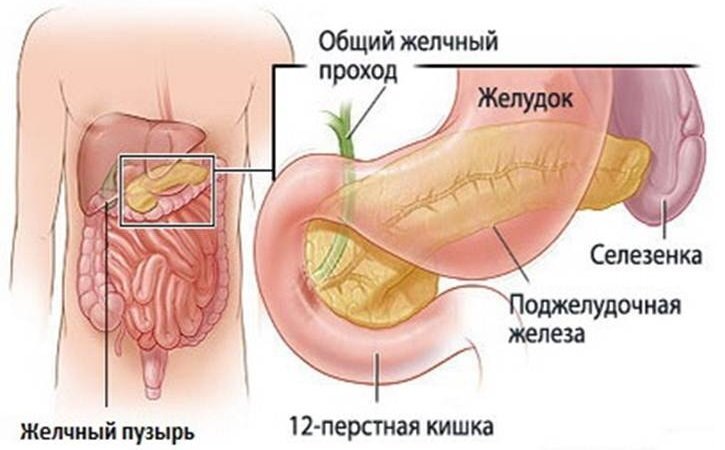 Панкреатит