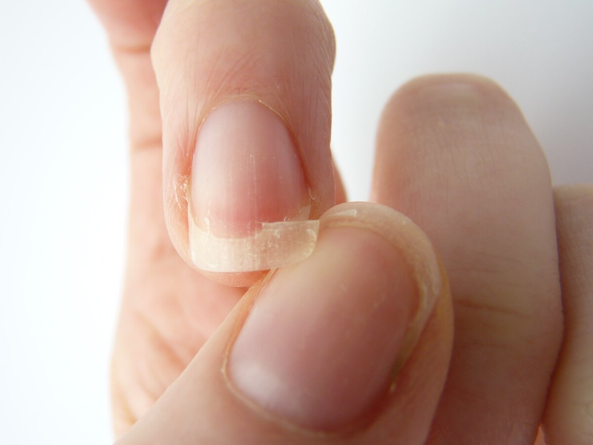 Кратко разберём, какие проблемы могут быть с ногтями и о каких неполадках организма они свидетельствуют.