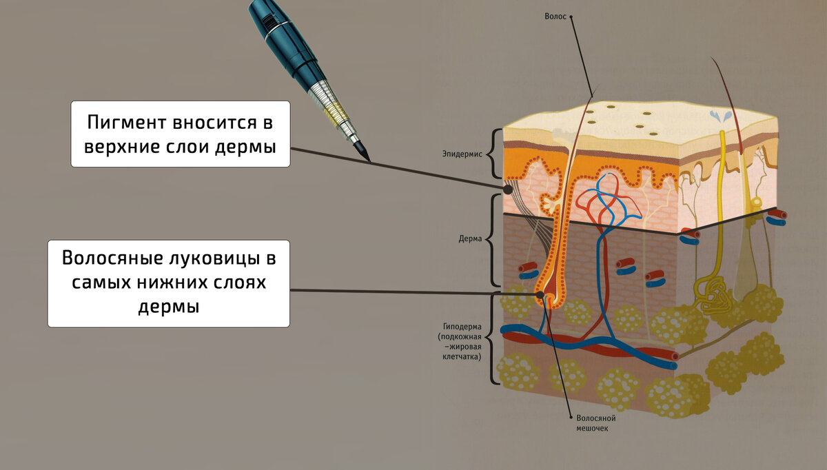 У меня выпали все ресницы после татуажа