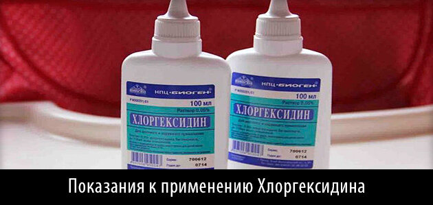 Полоскание рта после удаления зуба раствором “Хлоргексидина”: 4 важных правила