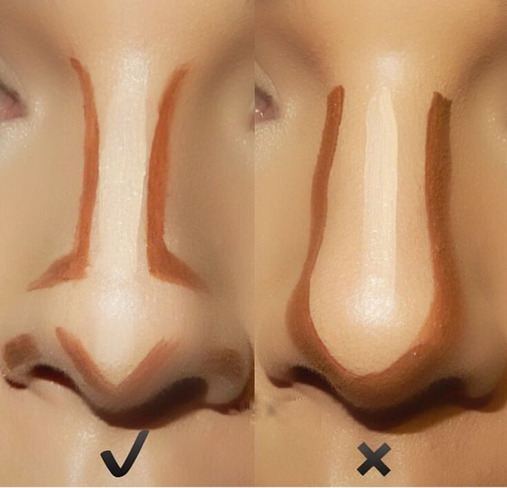 Как изменить вытянутую форму лица без пластической операции