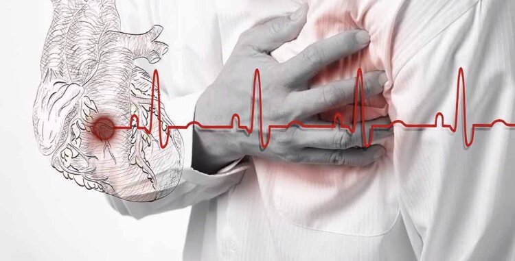 #ИБС#здоровье#важные#аспекты#физическая#нагрузка#нет#вредным#привычкам#правильное#питание#здоровый#образ#жизни