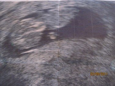 12 недель, рост 5 см)