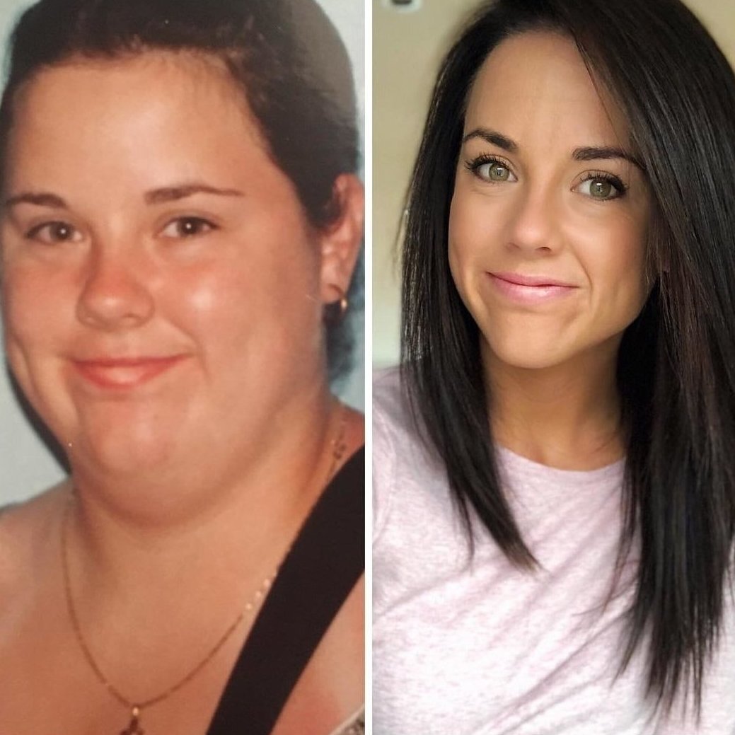Изменился в лице когда понял. Лицо до и после похудения. Толстое лицо до и после. Лицо после похудения до и после. Изменение лица после похудения.