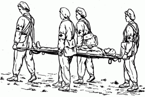  Правила транспортировки пациента с оскольчатым переломов плеча