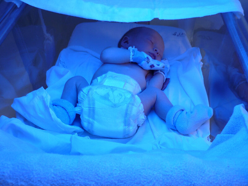 Тяжелый иммунодефицит. Дети в роддоме под лампой. Новорожденного в роддоме под лампой. Иммунодефицит новорожденных. Синие дети новорождённые.