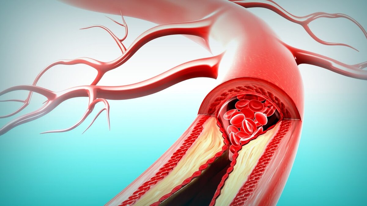 Кровеносные сосуды играют ключевую функцию в организме. Они являются транспортными магистралями для кислорода и питательных веществ, доставляя их к органам и тканям.