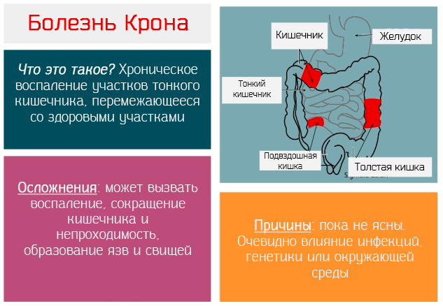 Краткая информация о болезни Крона.