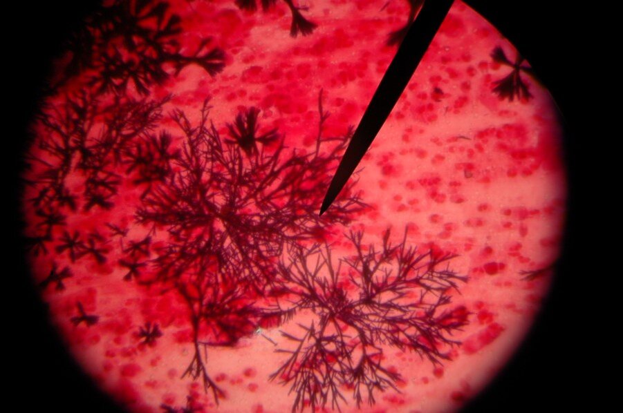 Нити под микроскопом