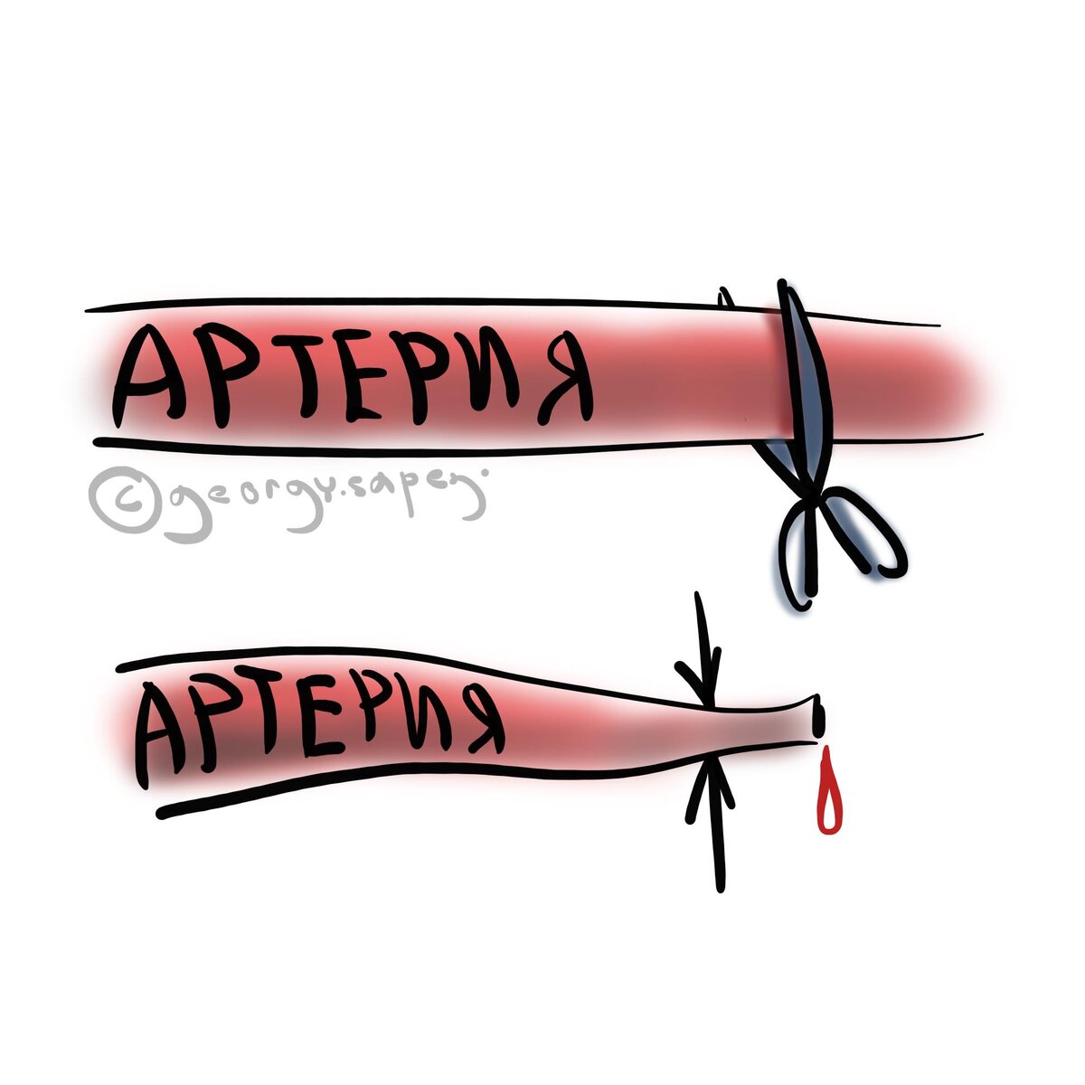 Перерезанная артерия спазмируется.