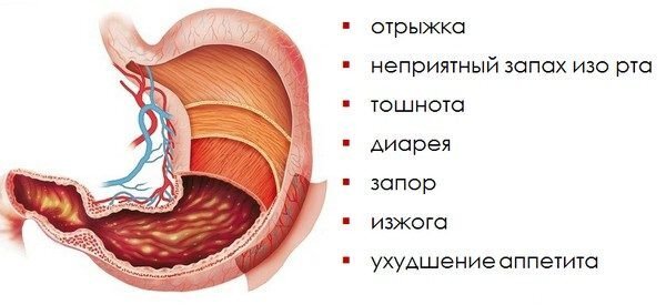 Тошнота отрыжка изжога жидкий стул