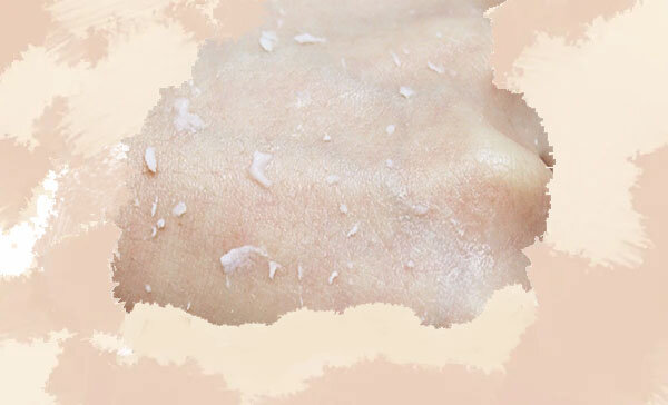 текстура пилинга после скатывания