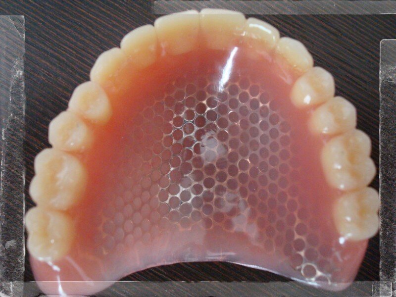 Базис протеза материалы. Пластиночный протез с металлическим базисом. Съемный пластиночный протез. Армированный съемный протез.