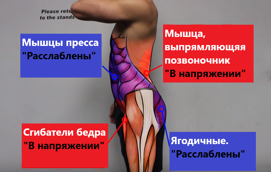 Что такое лордоз: симптомы и лечение в домашних условиях