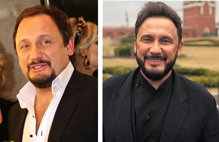 Артист до и после пластики?