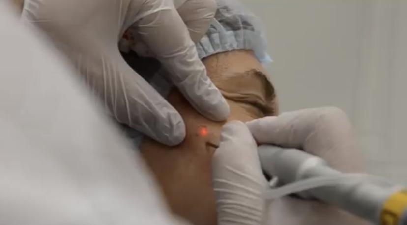 Зачем считать родинки?