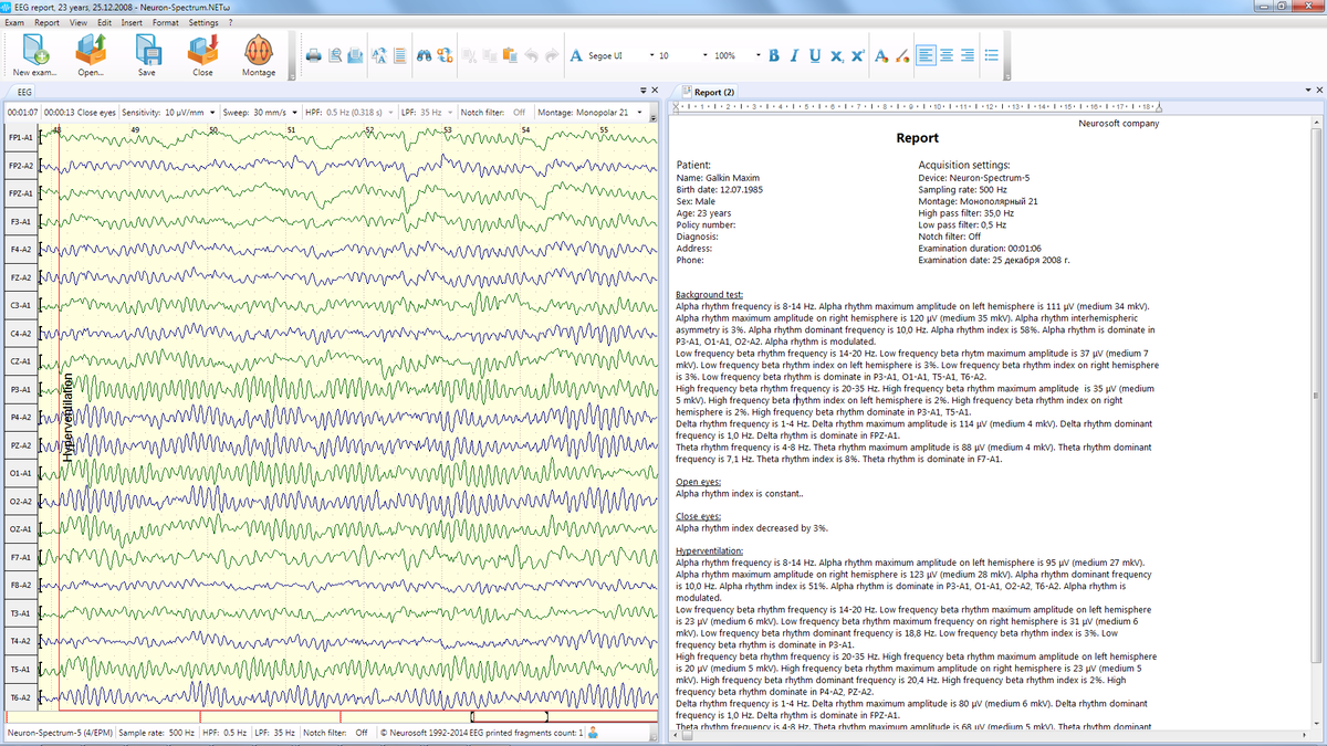 EEG report