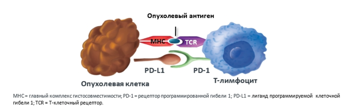 Отсутствие лимфоцитов