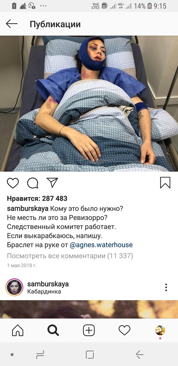 -2
