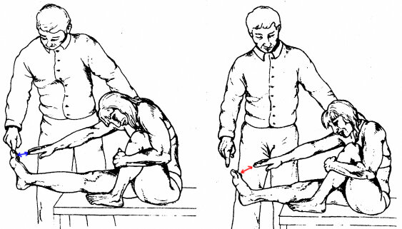 Изображение из книги "Клиническое исследование костей, суставов и мышц" К. Букуп