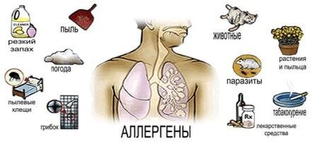 Аллергическая бронхиальная астма