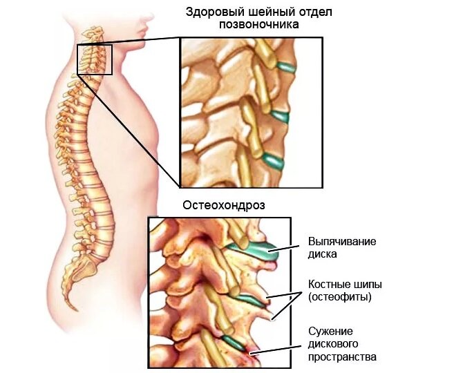 изображения взяты из открытых источников