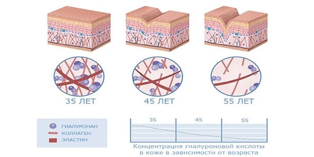 Снижение синтеза гиалурона в коже в зависимости от возраста