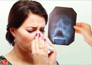 инфекция попадает в организм через кровь или носоглотку;