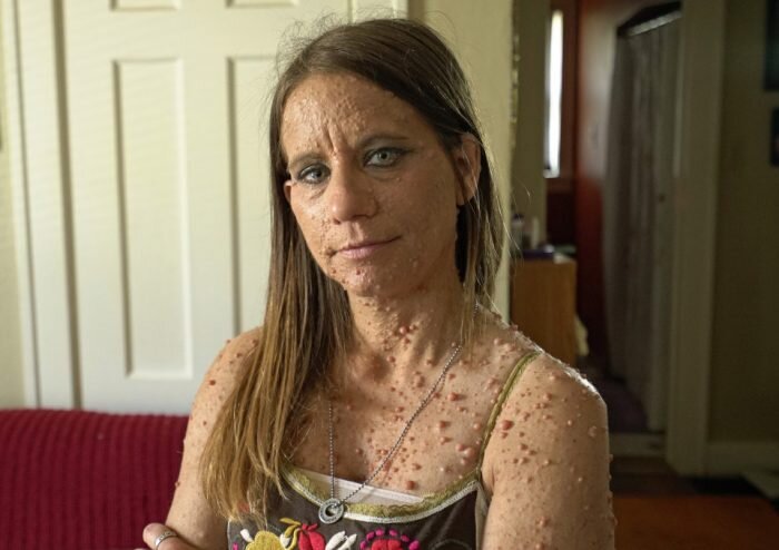 Так выглядела Либби до операции