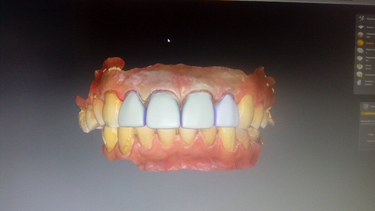 Моделировка