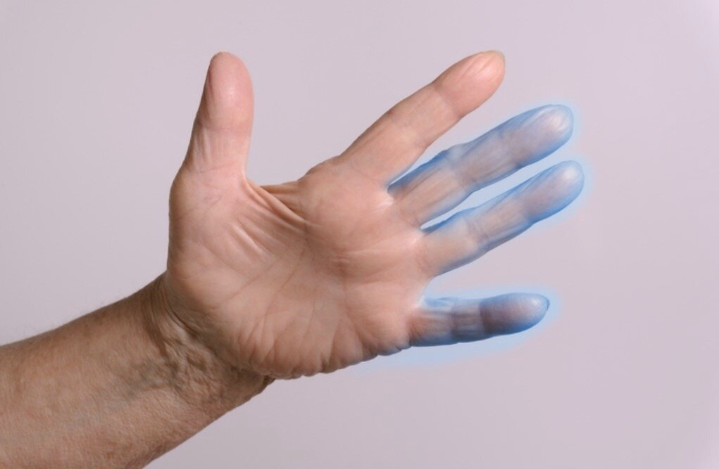 Человек лечащий руками как называется. Онемение конечностей руки.