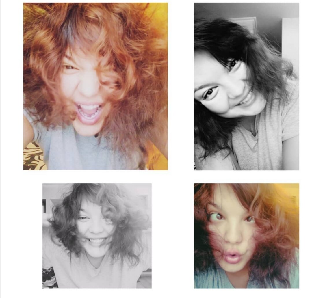 Хочу показать фото за месяц до операции в 2018 году. Я незнала что на столько затянется моё лечение. 