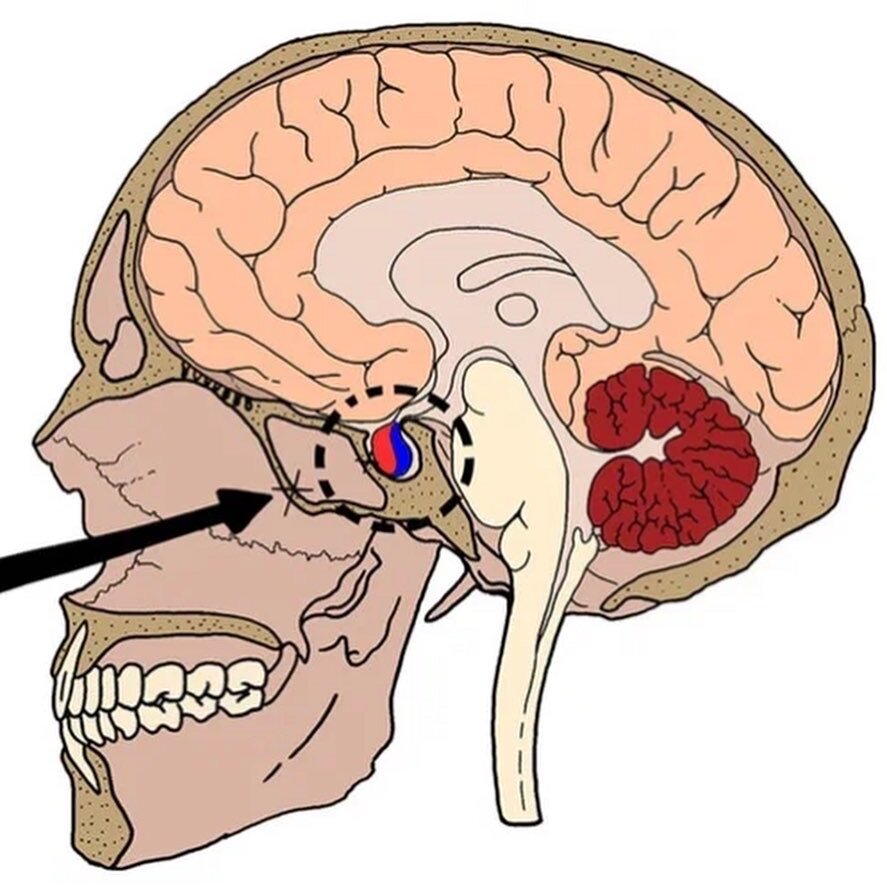 Гипофиз седло. Гипофиз в турецком седле. Анатомия турецкого седла в головном мозге. Турецкое седло в головном черепе. Турецкое седло и гипофиз в черепе человека.