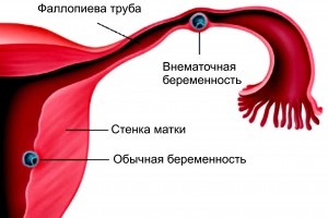 Источник: https://moydiagnos.ru