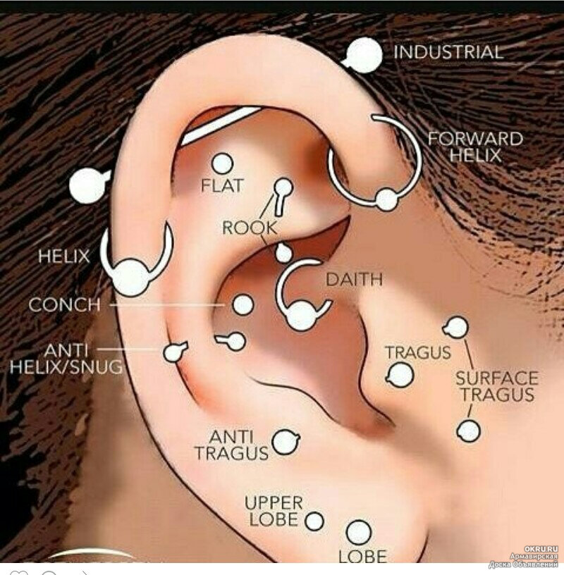 Схема проколов с названиями.