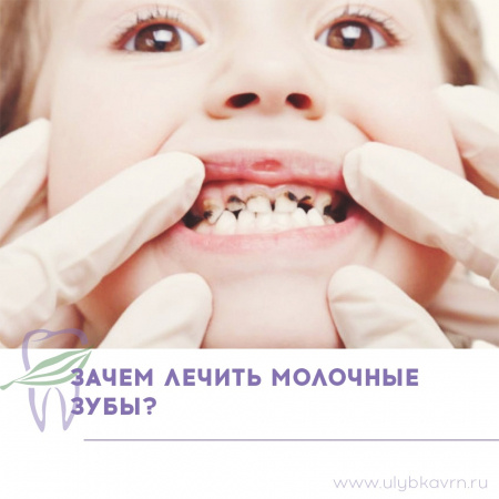 Многие родители задаются таким вопросом: «Зачем лечить молочные зубы, они же все равно выпадут?» Это совершенно неправильная точка зрения. Ответ однозначный: молочные зубы надо лечить обязательно!
Теперь объясним почему:
При поражении зубов кариесом во рту ребенка преобладают стрептококковые бактерии, которые повышают вероятность развития болезней горла, связок, желудочно-кишечного тракта, почек, сердца.

Разрушение молочных зубов в следствии кариеса влекут за собой нарушение прикуса постоянных зубов, проблемы с речью.

Кариес молочного зуба вредит растущему за ним постоянному зубу.

Удаленный раньше времени молочный зуб повлияет на искривление прикуса и зубного ряда ребенка. Для того, чтобы этого не произошло – проводят заместительное протезирование с помощью специальных конструкций, которые будут сохранять место для постоянного зуба и не дадут сместиться рядом стоящим зубам.