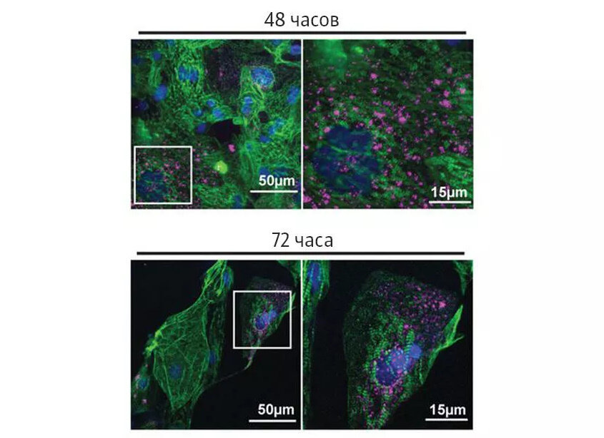 Повреждения сердечной мышцы, инфицированной SARS-CoV-2, через 48 и 72 часа после заражения