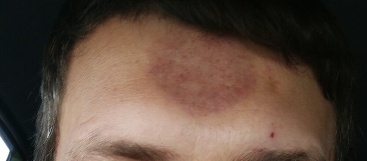 Фото взято из общего источника 