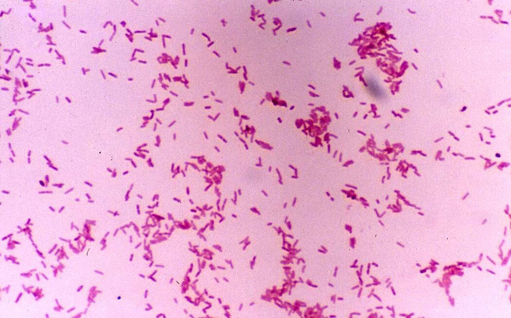 Бордетелла бронхисептика. Бордетеллы коклюша. Bordetella pertussis микробиология. Bordetella pertussis окраска по Граму. Коклюш микробиология.