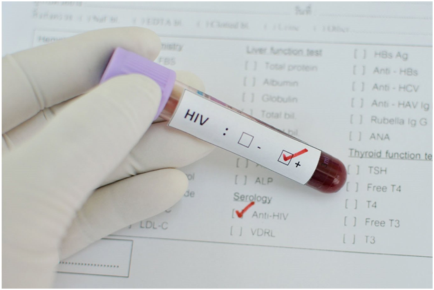 Анализ на ВИЧ. Фото из открытого источника