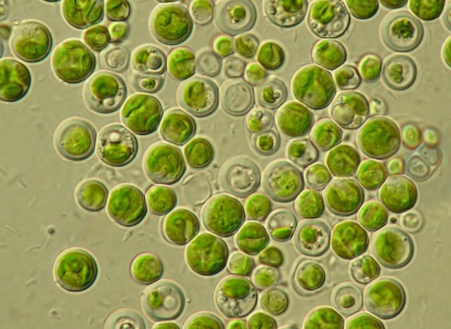 Одноклеточная водоросль хлорелла. Микроводоросли хлорелла. Хлорелла вульгарис. Микроводоросли хлорелла вульгарис.