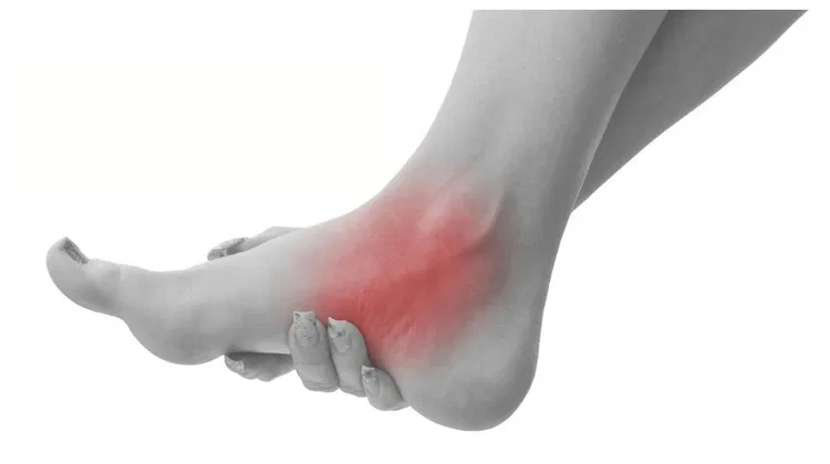 болит пятка 