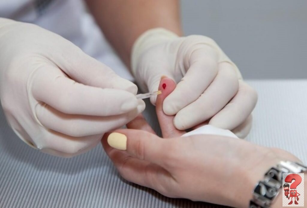 Как правильно сдавать кровь из пальца: основные правила подготовки к общему анализу крови из пальца