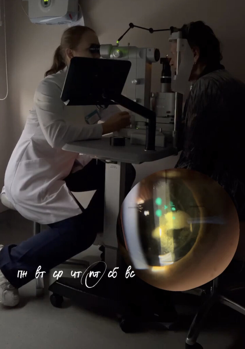 Как проводится лазерная дисцизия вторичной катаракты