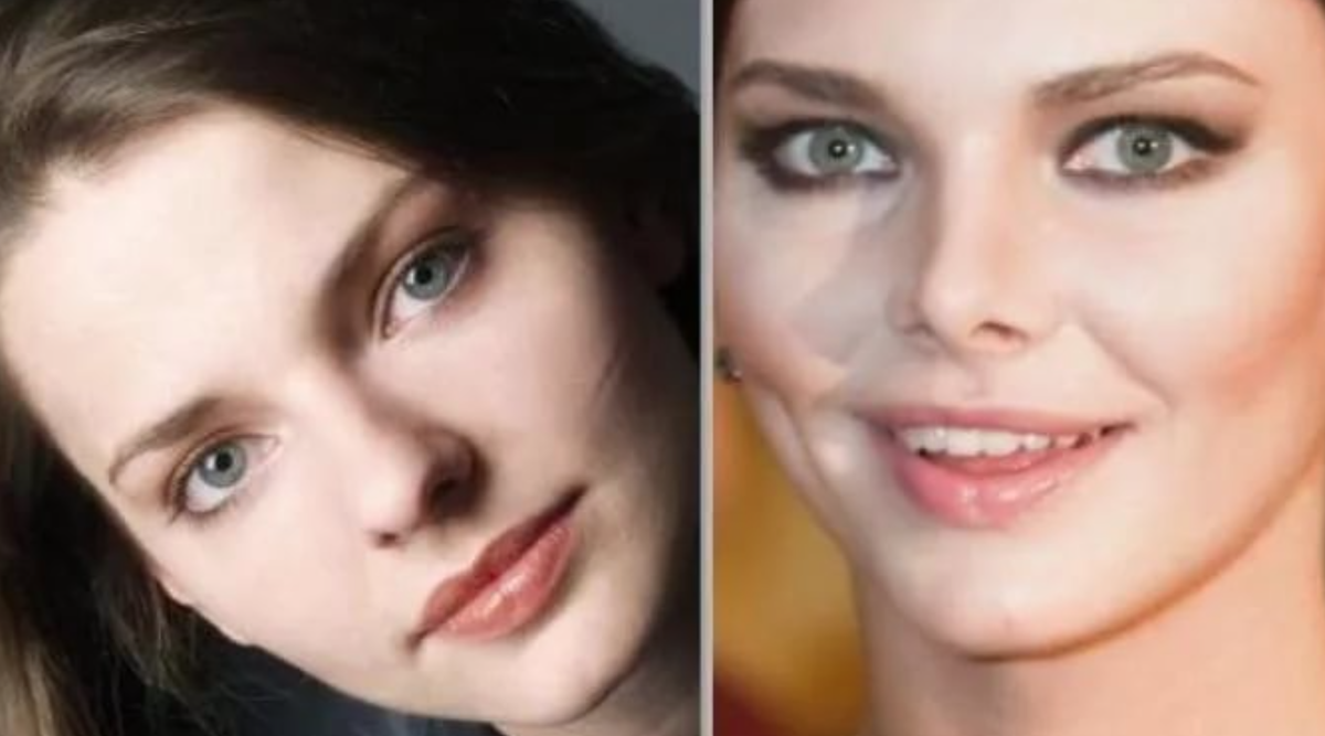 ПЛАСТИКА НОСА