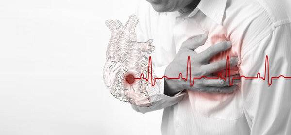 Незаметный инфаркт - можно ли перенести эту болезнь 