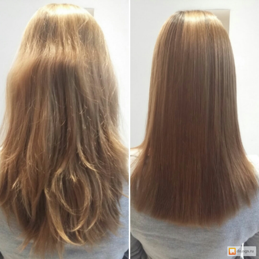 Волосы до и после лечения