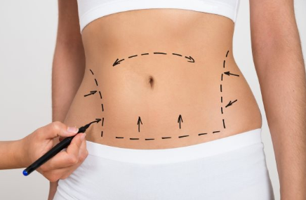 подготовка