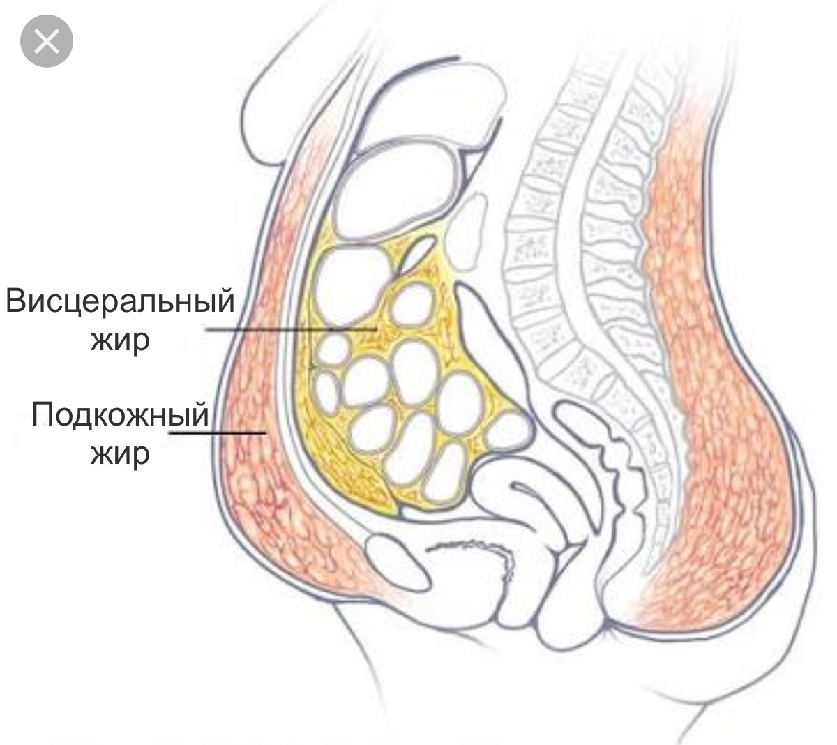 Жировая ткань живота: какая бывает; как убирается? | Наука для Всех | Дзен